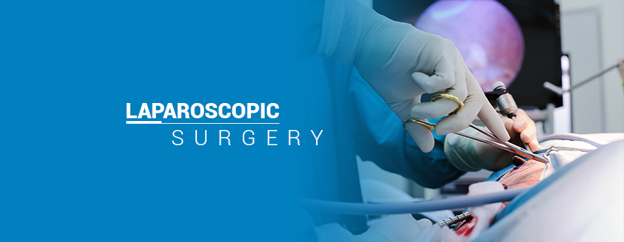 Laparoscopic Surgery