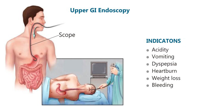 Upper GI Endoscopy